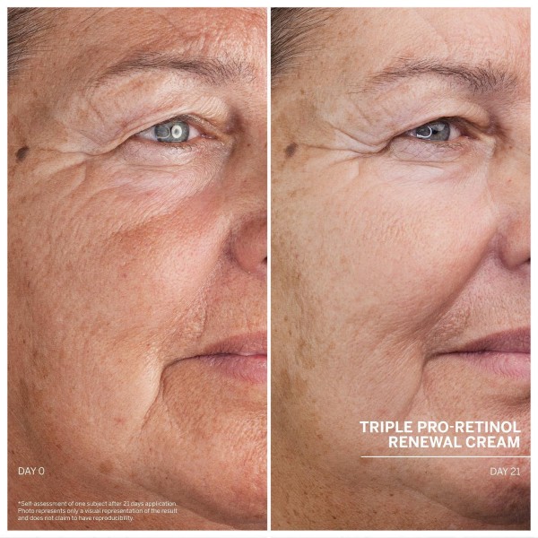 Triple Pro-Retinol Renewal Cream 50ml Doctor Babor